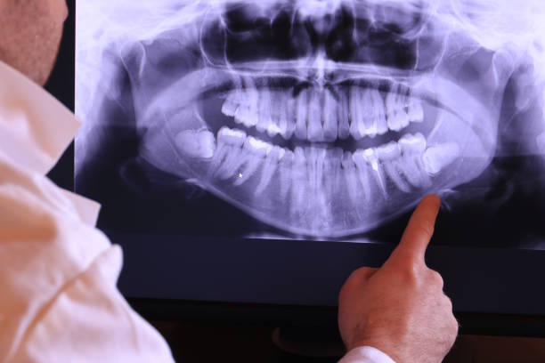 Best Emergency Dental Care for Sports Injuries in Manson, IA